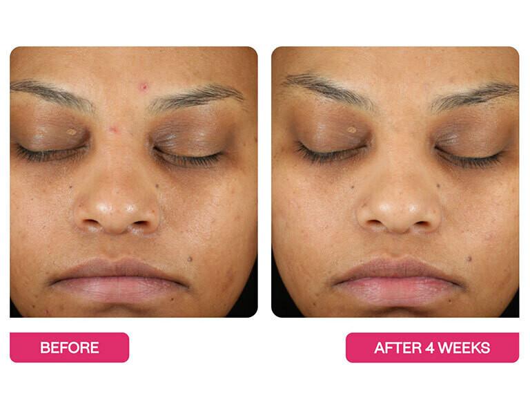 Resized Media/BeautyStat Peel Pads ALT 3