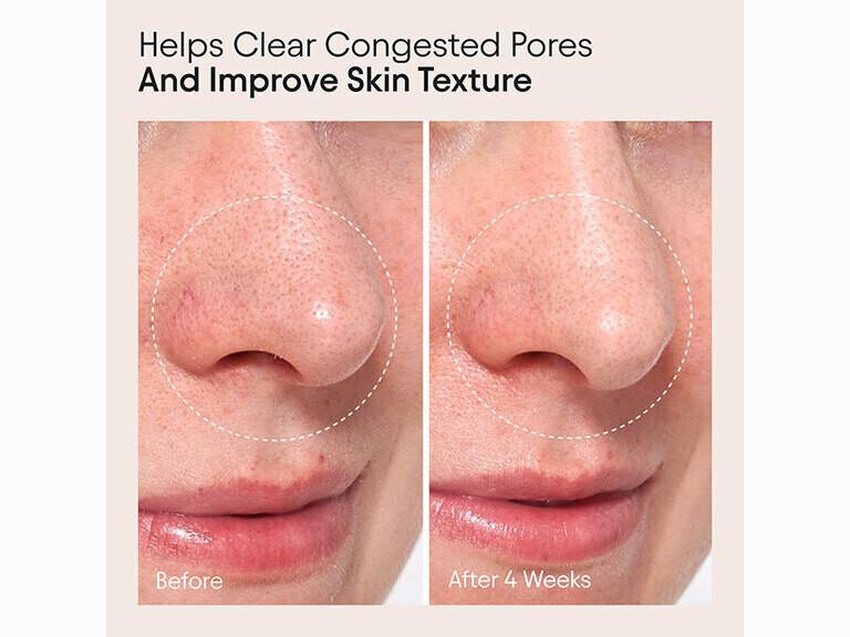 Resized Media/Clarifying Facial Oil 4