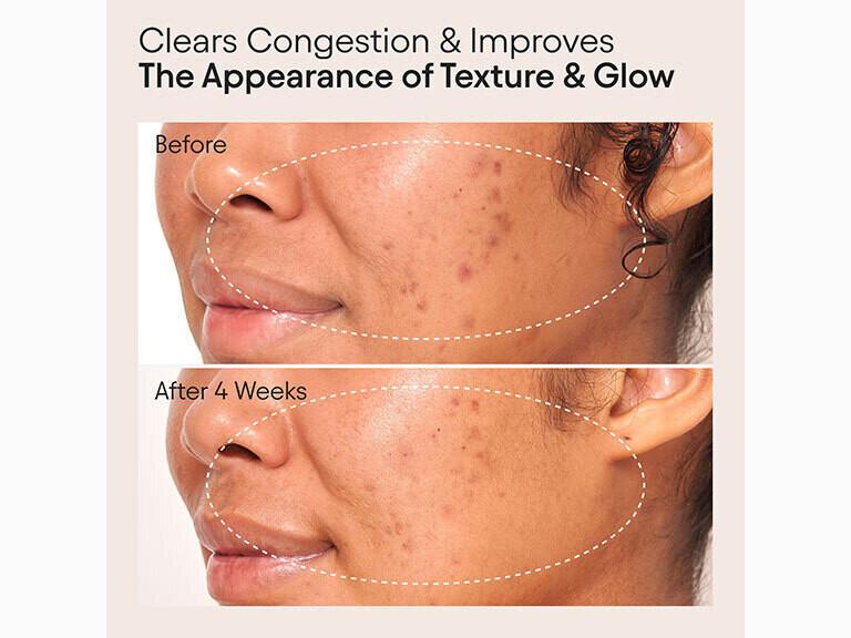 Resized Media/Clarifying Facial Oil 5