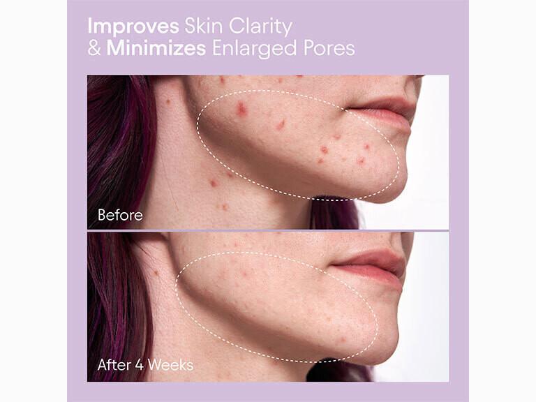 Pore Perfecting Liquid