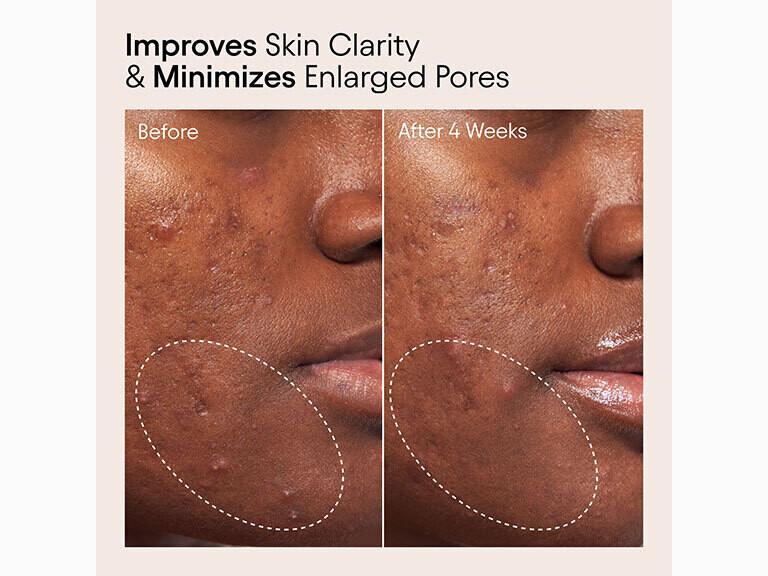 Pore Perfecting Liquid