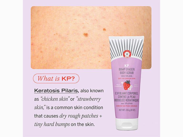 Resized Media/06 KPScrubStrawberry AltImage 2000x2000 2024 10 14 22 17 58