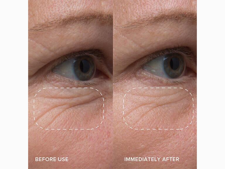 Resized Media/ALPYEYC1072990 ALPYN EYE BALM FULL 2