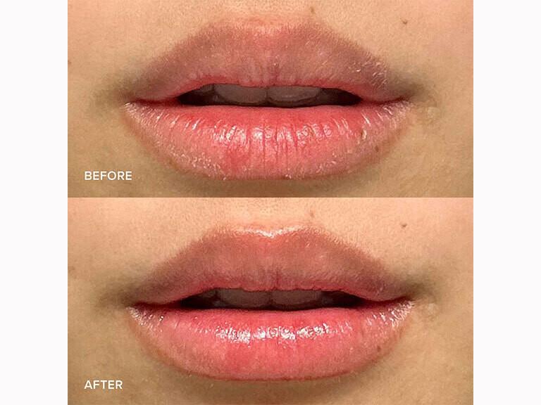 Resized Media/ALPYLCR1062409 2581213 2