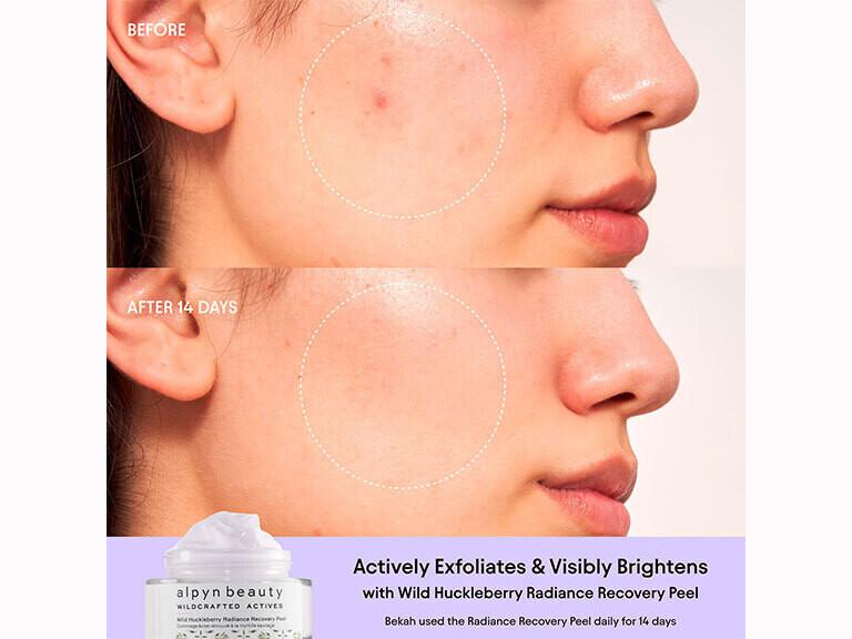 Resized Media/ALPYN HUCKLEBERRY PEEL FULL 2 1