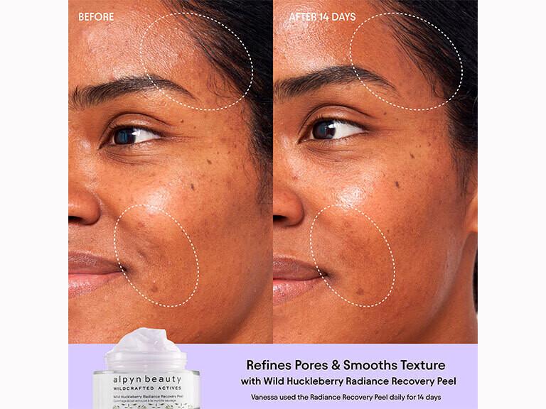 Resized Media/ALPYN HUCKLEBERRY PEEL FULL 3