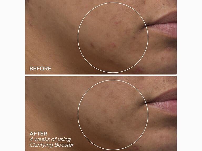 Resized Media/BEAUTYBIO BOOSTER CLARIFYING FULL 3