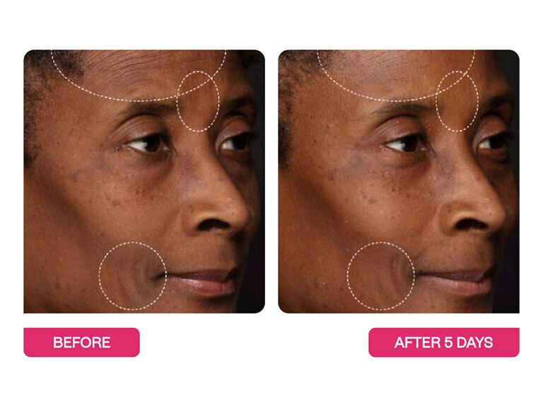 Resized Media/BSTAMST1065663 BSC33 5 1