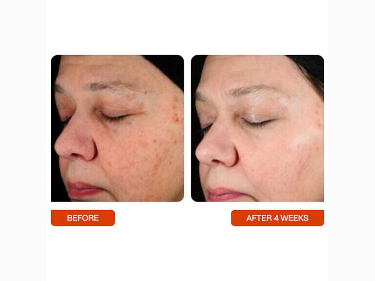 Resized Media/BSTASUN1073790 BeautyStat Universal Skin Refiner Full Size 5