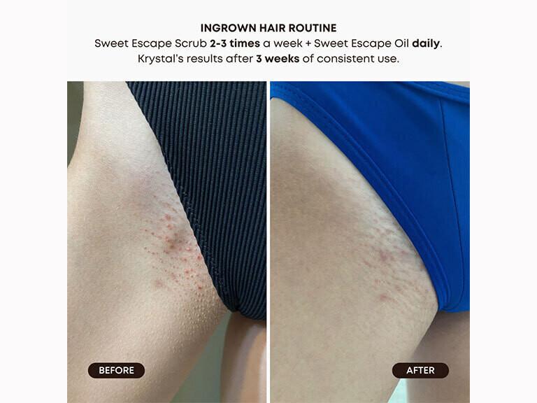 Sweet Escape Ingrown Hair Exfoliating Scrub