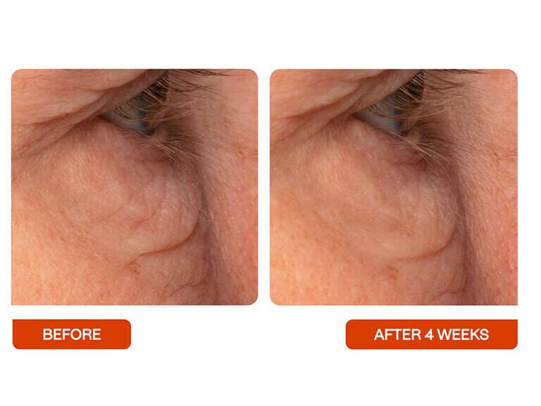 Resized Media/BeautyStat Universal EyeRe Full Size 5