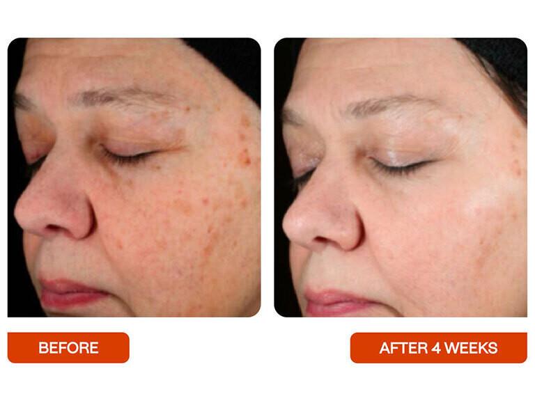 Resized Media/BeautyStat Universal Skin Refiner Full Size 5 1