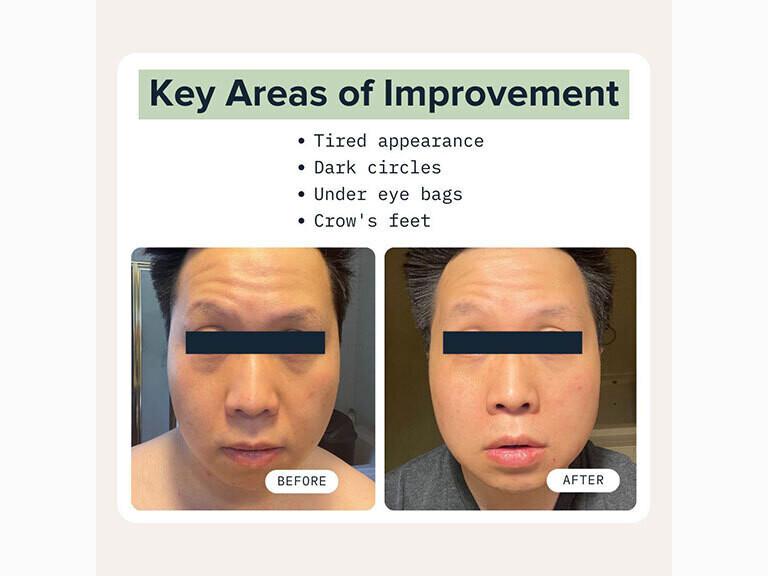 Resized Media/Cardon DarkCircleEyeRescue NoShade Full 7