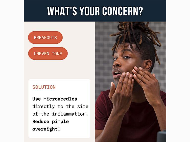 Resized Media/Cardon PricklyPimplePatch NoShade Full 4