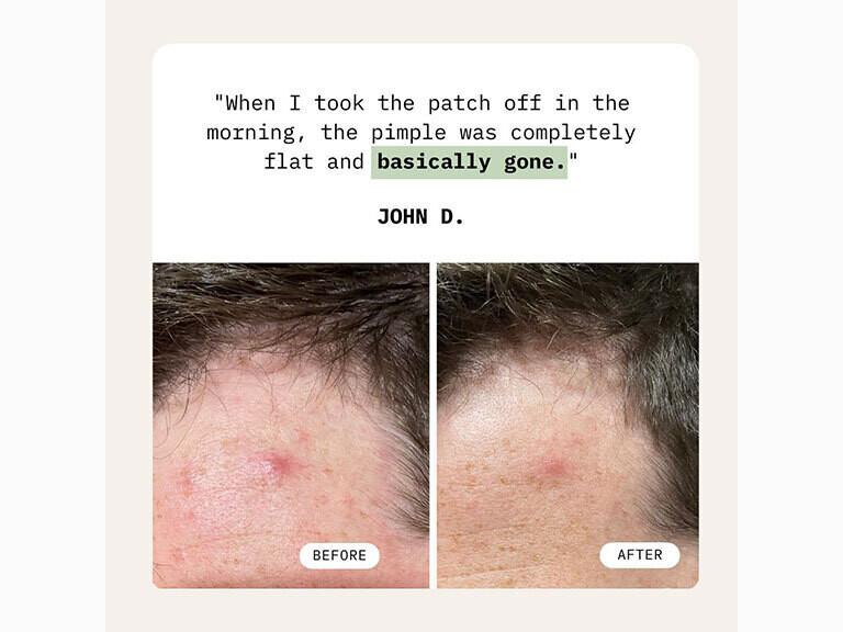 Resized Media/Cardon PricklyPimplePatch NoShade Full 9