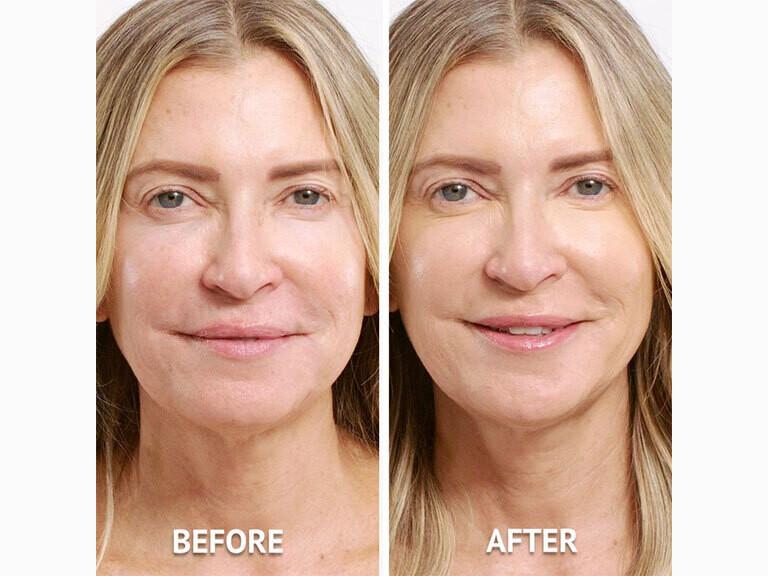 Resized Media/glamazon Beauty Hydrating Lip Gloss Before And After